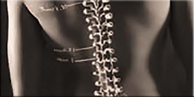 Thumbnail Image 1